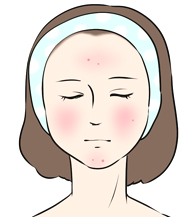 ニキビで赤くなる