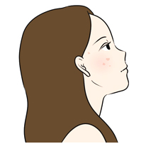 ニキビに悩む人にhttps://www.drsato02.com/nikibi/