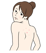 背中ニキビのコンプレックス